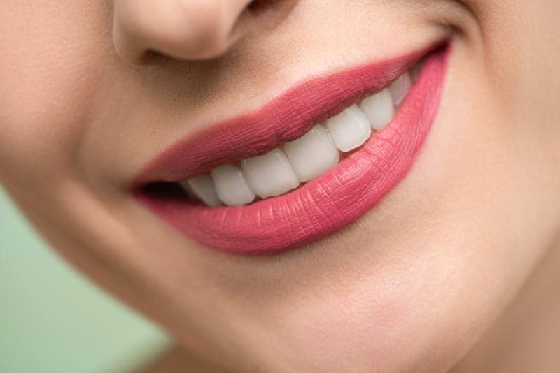 Como Manter Seus Dentes Brancos Após o Clareamento